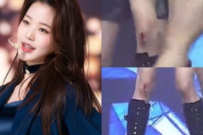 IVE'den Wonyoung performans sırasında dizini yaraladı.